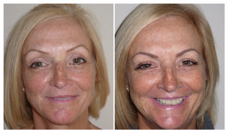 Amy packer permanent makeup eyebrows Permanent eyebrows before and after