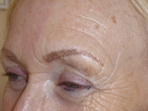 Natural hair simulation brows on a client with alopecia