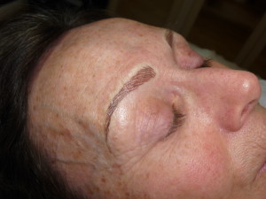 Natural Hair Simulation Brows on client with Alopecia