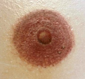 3d nipple tattoos breast reconstruction